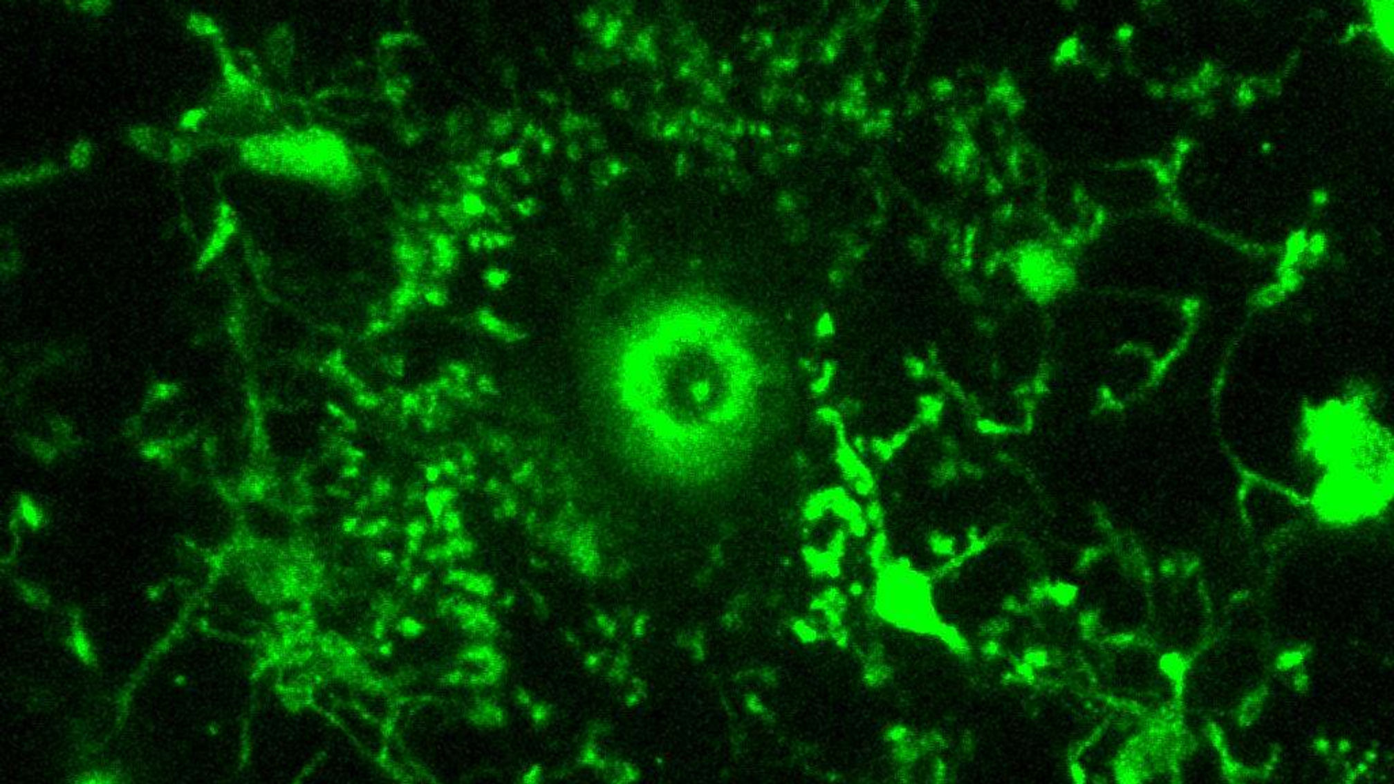 Microglia Respond to Laser-Induced Injury With Rapidly Chemotaxing Processes